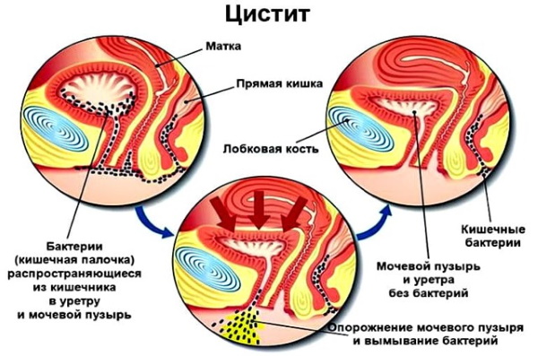 1 триместр беременности анализы. Список по неделям, таблица, какие сдавать