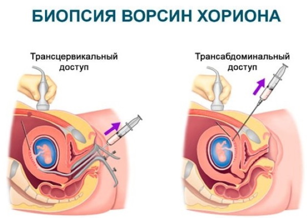 1 триместр беременности анализы. Список по неделям, таблица, какие сдавать