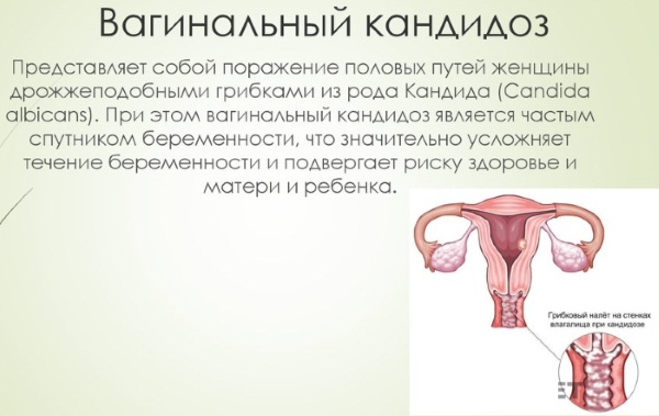 10 недель беременности. Фото живота, развитие плода, ощущения женщины, что происходит