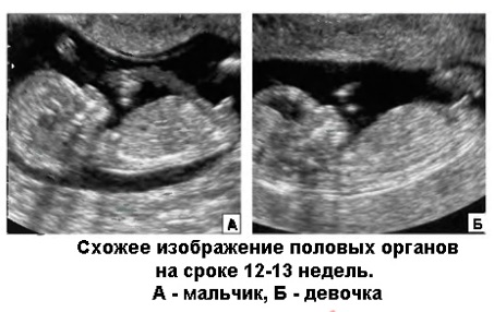 12 недель беременности. Фото живота, плода, УЗИ, что происходит, можно ли узнать пол ребёнка