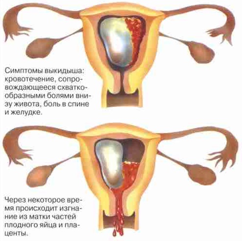 12 недель беременности. Фото живота, плода, УЗИ, что происходит, можно ли узнать пол ребёнка