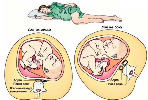 38 неделя беременности. Признаки приближающихся родов, что происходит с плодом, что чувствует женщина, развитие плода
