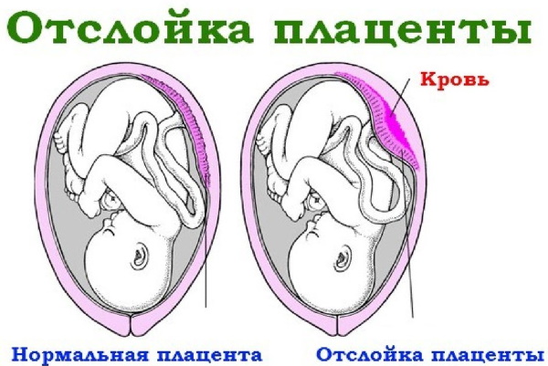 36-37 недель беременности. Что происходит с малышом и мамой, вес и рост ребенка, фото на УЗИ, если каменеет, тянет живот