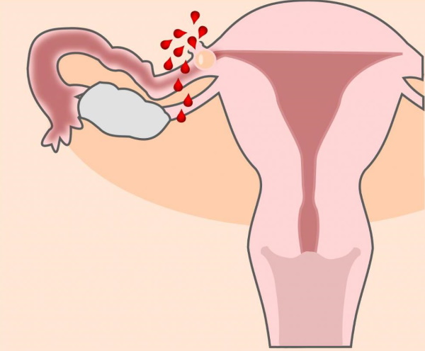 6 неделя беременности. Развитие плода, ощущения, что происходит, фото живота, плода на УЗИ