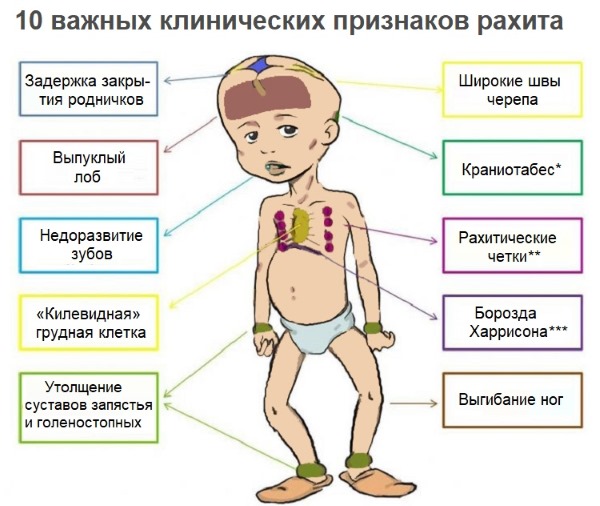 Аквадетрим для грудничка. Как давать, до какого возраста, симптомы передозировки. Отзывы