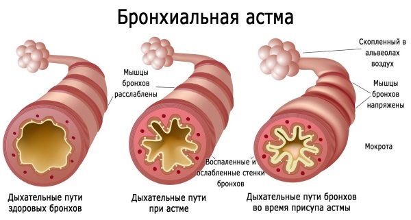 Разгрузочный день при беременности, при отеках, 1-2-3 триместр, меню на день, рецепты