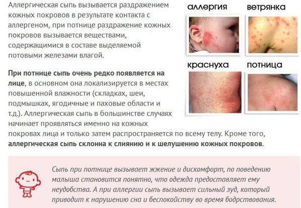 Аллергия у новорожденного пищевая при грудном вскармливании. Как выглядит на лице, ушах, теле. Лечение: капли, крема, мази