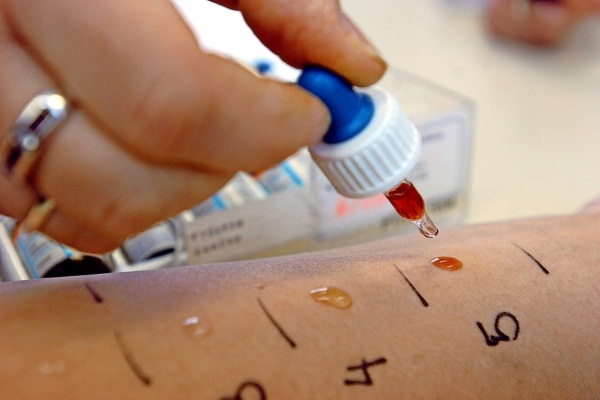 Аллергия у новорожденных. Фото на лице, теле, возле рта. Симптомы и лечение