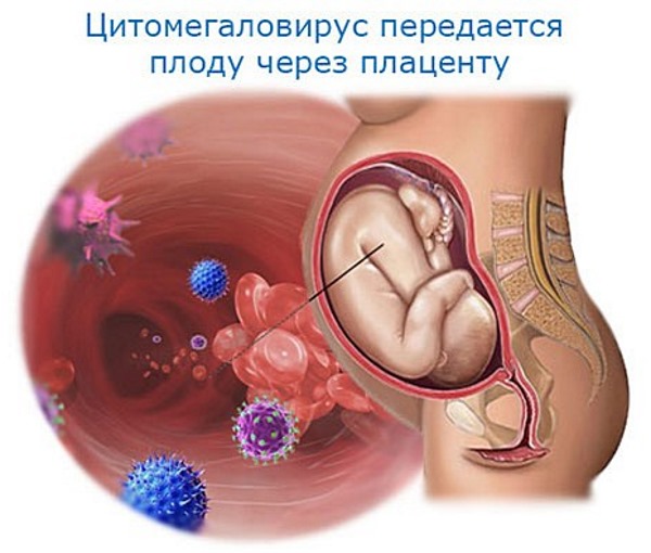 Ацикловир при беременности. Инструкция по применению мази, таблетки. Аналоги
