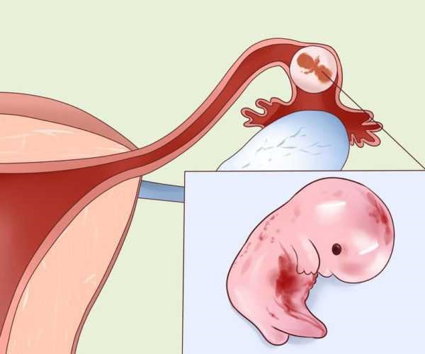 Ацикловир при беременности. Инструкция по применению мази, таблетки. Аналоги