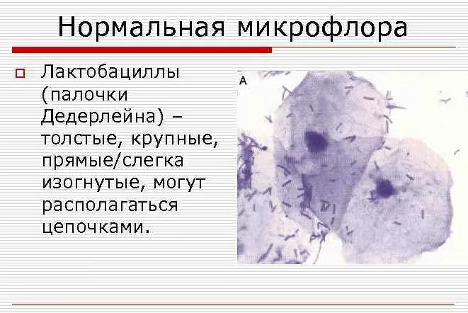 Бак посев (мазок) из цервикального канала при беременности: для чего