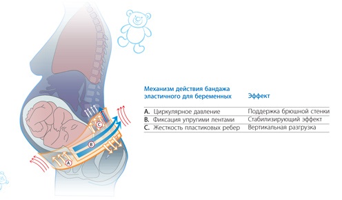 Бандаж для беременных. Какой выбрать, как правильно носить универсальный, дородовой, послеродовой, трусы, пояс-бандаж, поддерживающий