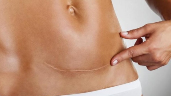 Бандаж для беременных. Какой выбрать, как правильно носить универсальный, дородовой, послеродовой, трусы, пояс-бандаж, поддерживающий