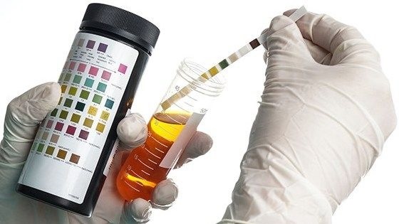 Белок в моче при беременности: причины и последствия для ребенка на ранних и поздних сроках, как снизить. Таблица норм