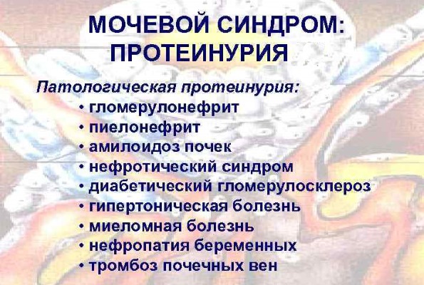 Белок в моче при беременности: причины и последствия для ребенка на ранних и поздних сроках, как снизить. Таблица норм