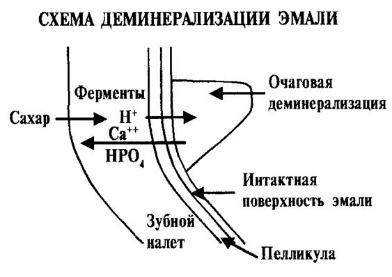 Белые пятна на зубах у ребенка. Причины и что делать, как избавится от пятен после отбеливания, брекетов, чистки, полосок
