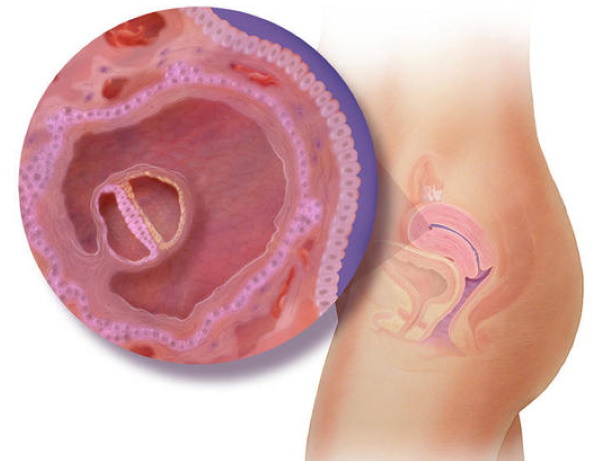 Беременность 5 акушерских недель. Что происходит, УЗИ, размер, развитие плода, ощущения беременной