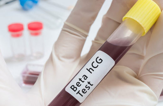 Признаки беременности на ранних сроках, до задержки, многоплодная, внематочная, двойней, замершая, осложнения