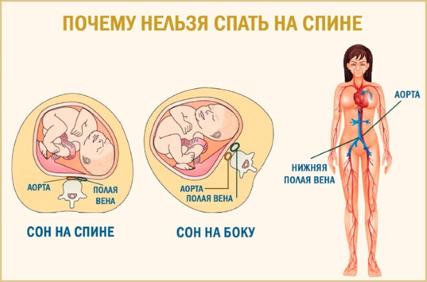 Почему беременным нельзя спать на спине. С какого срока