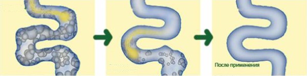 Бифидумбактерин для новорожденных. Инструкция по применению, дозировка, как разводить, давать ребенку. Отзывы