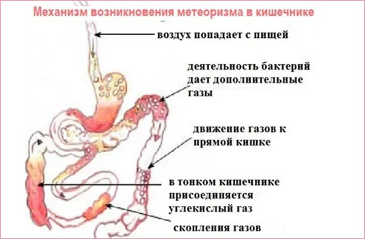 Боли в желудке при беременности. Что делать, что можно принимать, как лечить