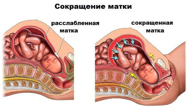 Матка при беременности на ранних сроках на ощупь. Размеры
