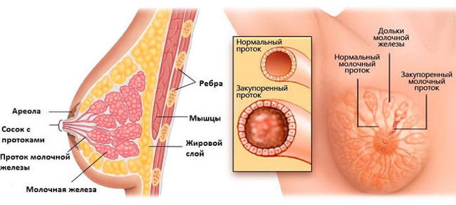 Бугорки Монтгомери при беременности. То это такое, фото, причины появления, воспаление