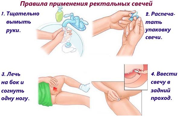 Бускопан свечи. Инструкция по применению перед родами, при беременности, для детей. Аналоги, отзывы