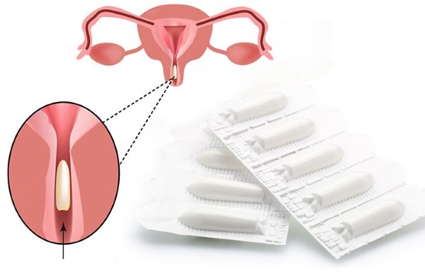 Бускопан свечи. Инструкция по применению перед родами, при беременности, для детей. Аналоги, отзывы