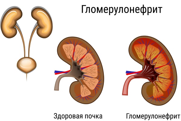 Чешется живот при беременности на ранних сроках, во втором, третьем триместре