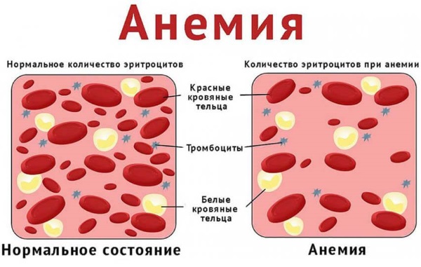 Что нельзя беременным в первом триместре, втором, третьем, делать и кушать, список запретов