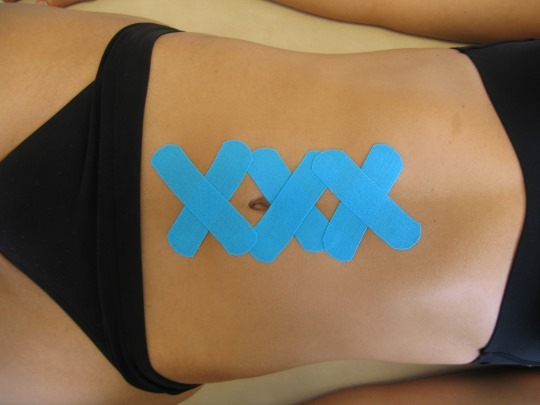 Диастаз после родов - что это, как определить, симптомы, лечение, как устранить, упражнения гимнастики, физиотерапевтические процедуры и операция