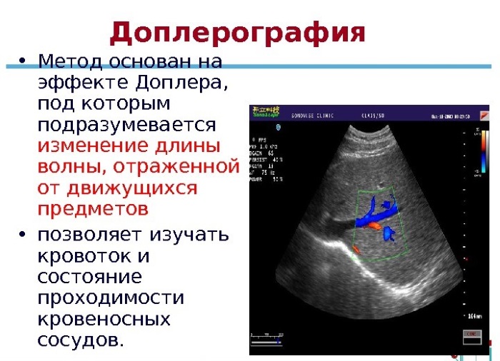 Доплер УЗИ беременных. Что это такое, как делают, на каком сроке, вреден ли