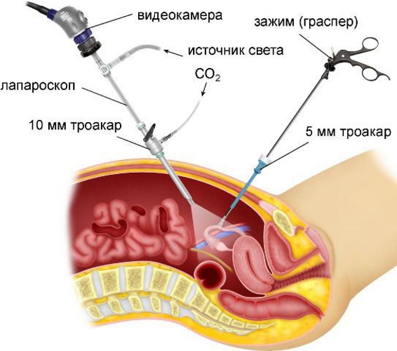 Двурогая матка и беременность. Что это такое, причины у женщин, как выглядит, что значит, плохо ли, можно ли забеременеть