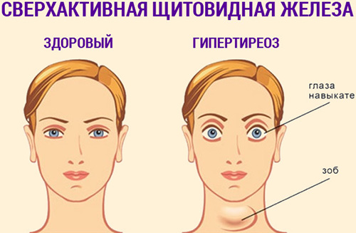 Фемибион 1/2 при планировании беременности, на ранних сроках. Отзывы, кому помог, инструкция по применению