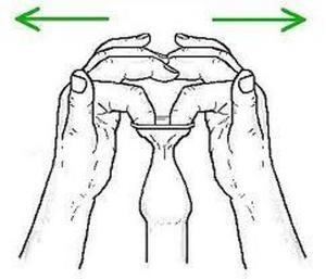 Фимоз у мальчиков. Фото, что это такое, лечение в домашних условиях, операция