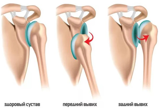 Греко-римская борьба для детей. Польза и вред, отзывы