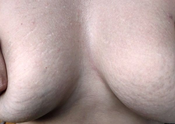 Грудь при беременности. Фото изменений, увеличение чувствительности, боли, уменьшилась, чешется, набухает