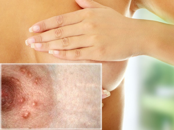 Грудь при беременности. Фото изменений, увеличение чувствительности, боли, уменьшилась, чешется, набухает