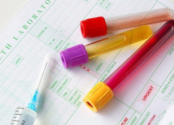 7 неделя беременности акушерская. Развитие плода и ощущения, что происходит, фото живота