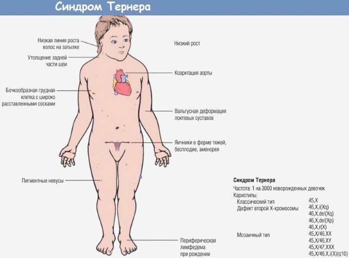 ХГЧ при беременности: норма, таблица от зачатия по дням. Расшифровка анализа крови, как растет уровень. Показатель после ЭКО
