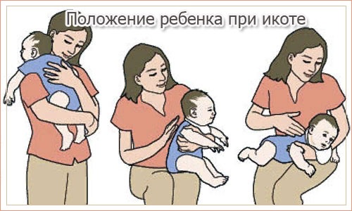 Икота у новорожденного после кормления смесью, грудным молоком. Как остановить, избавиться
