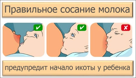 Икота у новорожденного после кормления смесью, грудным молоком. Как остановить, избавиться