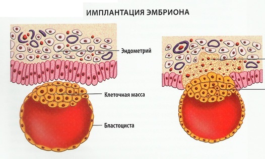 Имплантационное кровотечение. Фото, что это такое, у всех ли бывает, когда делать тест на беременность, на какой день происходит после переноса эмбрионов