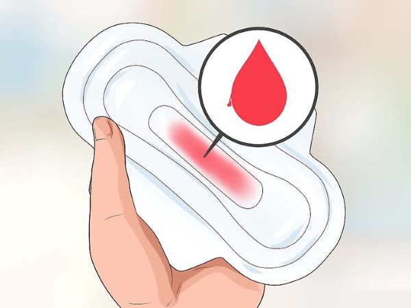 Имплантационное кровотечение. Фото, что это такое, у всех ли бывает, когда делать тест на беременность, на какой день происходит после переноса эмбрионов