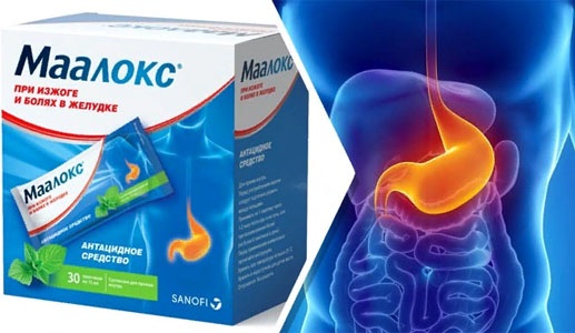 Изжога при беременности. Причины, как избавиться, лечение: народные средства, препараты