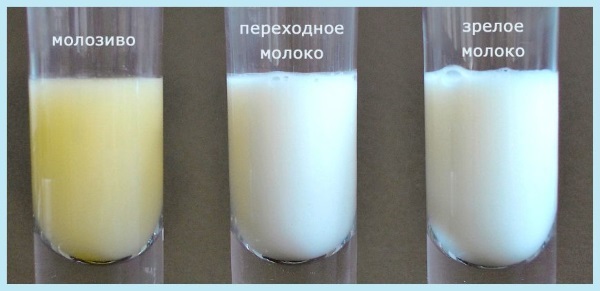 Как болит грудь при беременности на ранних сроках, во втором, третьем триместре. Когда начинает, перестает, как меняются железы