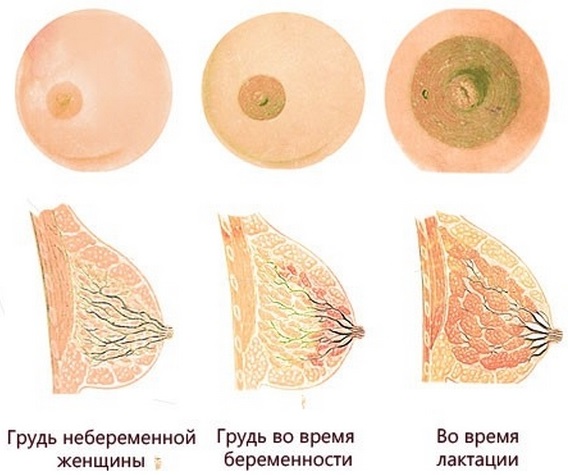 Как болит грудь при беременности на ранних сроках, во втором, третьем триместре. Когда начинает, перестает, как меняются железы