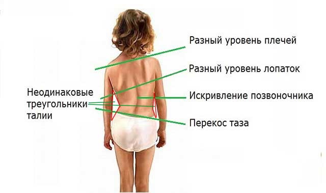 Как делать колесо для начинающих детей. Гимнастика дома