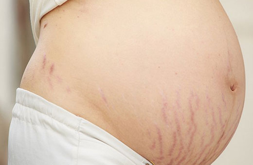 Как не поправиться при беременности. Как правильно питаться, меню на каждый день